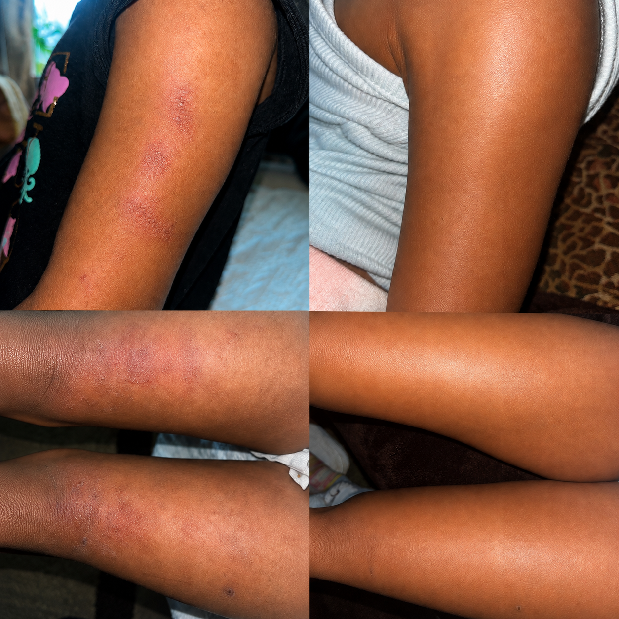 - mother of three year old SH